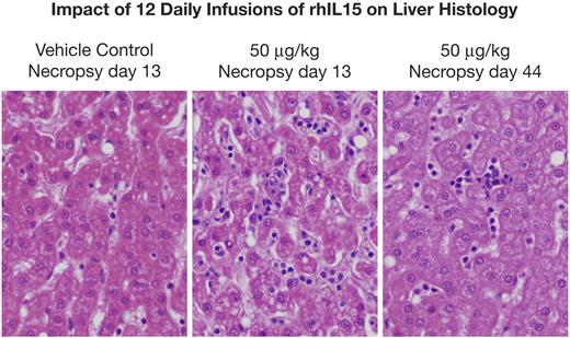 Figure 4. rhIL-15 administration is associated with an enlarged liver with normal hepatocytes, but with the presence of leukocytes including lymphocytes and neutrophils in the liver sinusoids. Left panel is the liver histology of an animal receiving vehicle control for 12 days with a necropsy on day 13. Center panel is the liver histology of an animal receiving 50 μg/kg/d for 12 days, with necropsy at day 13, showing normal hepatocytes but the presence of leukocytes including lymphocytes and neutrophils in the liver sinusoids. Right panel is the liver histology of an animal receiving 50 μg/kg/d of rhIL-15 for 12 days with necropsy at day 44, showing a return toward a normal pattern.