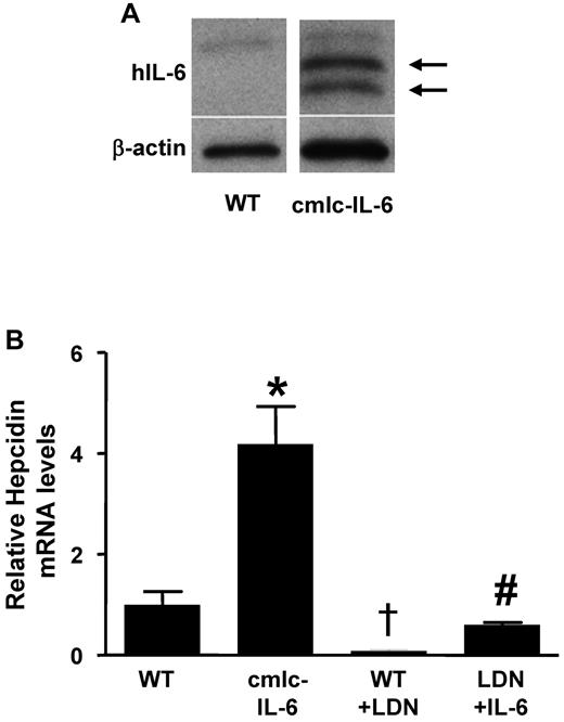Figure 2. LDN-193189 inhibits the induction of hepcidin by inflammation in zebrafish. (A) Human IL-6 protein was detected in homogenates of double transgenic (cmlc-IL-6) but not in those of WT zebrafish hearts (arrows). β-actin was used to control for protein loading. (B) Hepcidin mRNA levels were measured by qRT-PCR in the livers of 7-day-old WT and cmlc-IL-6 zebrafish treated with vehicle or LDN-193189 (6μM) for 16 hours. (n = 3, *,†P < .05 vs WT, #P < .05 vs cmlc-IL-6).