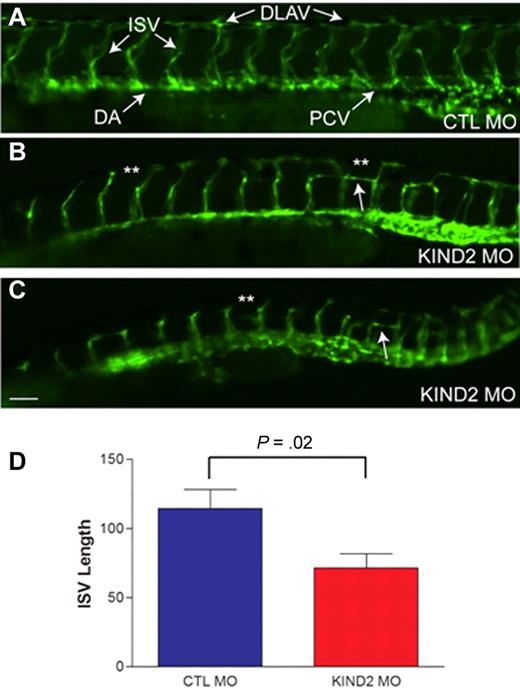 Figure 4. Morpholino mediated knockdown of zebrafish kindlin-2 results in abnormal developmental angiogenesis. (A) Control morphant (CTL MO) embryo examined by live microscopy at 48 hpf. Proper vessel formation was observed in all control morphant embryos. ISV indicates intersegmental vessel; DLAV, longitudinal anastamotic vessel; DA, dorsal aorta; and PCV, posterior cardinal vein. (B-C) Two examples of kindlin-2 morphants (KIND2 MO). DLAVs were discontinuous and absent in many places (**). ISVs were thin and short. Aberrant horizontal interconnecting vessels were also frequently observed (arrows). Scale bar, 50 μm. (D) Quantitation of total ISV length. ISVs were measured at 48 hpf in control and kindlin-2 morphants. Average values (in micrometers) were (CTL vs KIND2): 114 ± 14 versus 71 ± 10; P = .02. Four independent experiments were performed with 10 fish per group.