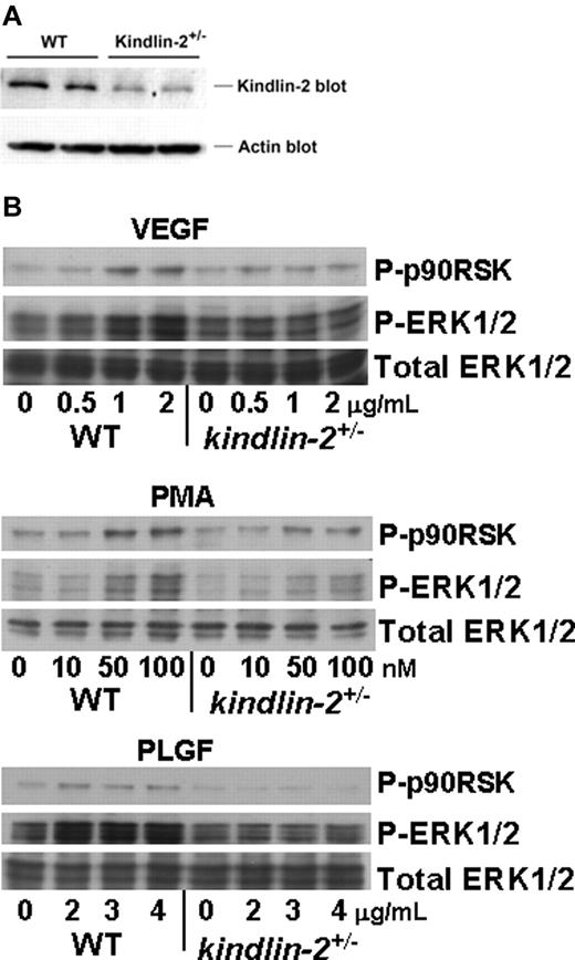 Figure 5. Comparison of receptor expression and intracellular signaling in WT and kindlin-2+/− aortic endothelial cells. (A) Kindlin-2 expression is reduced by ∼ 50% in kindlin-2+/− compared with WT ECs. Representative Western blots of EC lysates probed with anti-kindlin-2 and anti-actin (loading control) Abs are shown. Each band represents kindlin-2 or actin expression in ECs isolated from single individual mouse. ECs from 5 WT and 7 kindlin-2+/− mice were analyzed in 1 experiment. (B) VEGF, PMA, and PLGF induce phosphorylation of ERK1/2 and p90RSK in WT, but not in kindlin-2+/− ECs. The cells were incubated with increasing concentrations of soluble activators for 10 minutes at 37°C and lysed as described in “WT and kindlin-2+/− aortic ECs.” Western blots were probed with Abs to phospho-ERK1/2, phospho-p90RSK, or total ERK1/2 (loading control). The images are representative of 2 independent experiments.