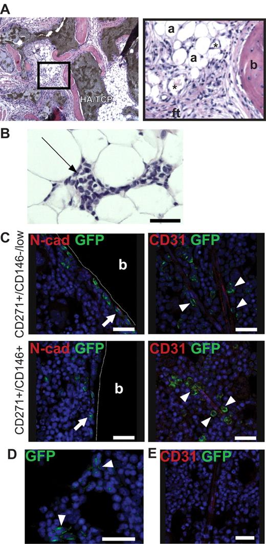 Figure 4. Ectopic and orthotopic transplantation of cultured cells into immunodeficient mice. Multiclonal cultures generated from CD271+/CD45−/CD146−/low and CD271+/CD45−/CD146+ primary BM-MNCs were transplanted either subcutaneously (with HA/TCP particles) or intrafemorally into immunodeficient mice. (A-B) Representative section of hematoxylin/eosin–stained transplanted cells and HA/TCP carrier particles 8 weeks after subcutaneous transplantation of CD271+/CD45−/CD146+–derived MSCs. (A) Bone (b), adipocytes (a), fibroblastic tissue (ft), and capillaries (*) are indicated. Dark brown areas in the left photograph indicate HA/TCP carrier particles. Black square in the left photograph is shown as a magnification (original magnification 10×). (B) Invading hematopoietic cells could be detected in the transplanted cells (black arrow). Original magnification was 10×. Scale bar indicates 50 μm. (C) GFP+ cells generated from either CD271+/CD45−/CD146−/low (top row) or CD271+/CD45−/CD146+ (bottom row) cells analyzed 8 weeks after intrafemoral transplantation. GFP+ cells (green) could be detected as bone-lining cells, some of which expressed N-cadherin (N-Cad, red) (white arrows, left panels), and in perivascular regions surrounding the endothelium (CD31, red) (white arrowheads, right panels). (D) Reticular GFP+ cells (green) could be detected independently from vessels in the marrow space (white arrowheads). The photograph shows reticular GFP+ cells generated from CD271+/CD45−/CD146−/low cells. (E) Bone marrow section from a control mouse (injected with Dulbecco PBS only) stained with anti–GFP and CD31 antibody. Nuclei were stained with TO-PRO3 (blue). Cortical bone (b) is indicated. Scale bars indicate 25 μm. The photographs were taken with a confocal microscope (DMRE; Leica).