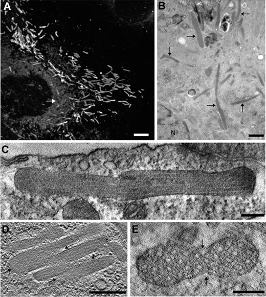 Figure 1. Morphology of WPBs in nonstimulated cells. (A) Immunofluorescence image of a human umbilical vein endothelial cell (HUVEC) labeled with an antibody against VWF, revealing the numerous elongated WPBs throughout the cell. Note the reticular staining representing the ER (white arrow). Scale bar represents 5 μm. (B) EM image of a HUVEC showing several WPBs (arrows). N, nucleus. Scale bar, 1 μm. (C-E) Digital slices through electron tomograms of WPBs displaying irregular shapes suggesting homotypic fusion between WPBs.3 (C) The delimiting membrane of the WPB is not straight along the long axis of the WPB. Scale bar, 200 nm. (D) Several WPBs are aligned against each other and are connected at some extremities (arrows). Scale bar, 200 nm. (E) Transverse section of an atypical WPB with an oval shape displaying 2 indentations (arrows). Scale bar, 100 nm.