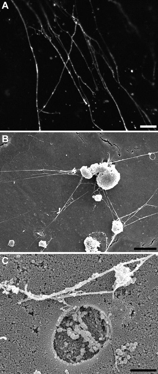 Figure 6. Morphology of VWF strings. (A) Immunofluorescence image of a stimulated HUVEC labeled with an antibody against VWF showing numerous VWF strings branching at the surface of the cell. Scale bar represents 5 μm. (B) Scanning EM of VWF strings at the surface of stimulated HUVECs displaying numerous branching VWF strings. Note the presence of pore in the membrane (right top corner). Scale bar, 5 μm. (C) Scanning EM of a pore in the membrane representing the site of exocytosis of WPB. VWF strings are branching and bundling at the surface of the cell. Scale bar, 1 μm.