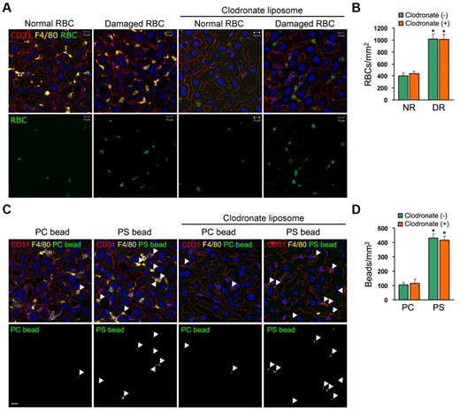 Figure 1. Damaged RBCs are sequestered in the hepatic sinusoid in a PS-dependent manner regardless of the presence of Kupffer cells. (A) Clodronate liposome-treated or control (PBS-treated) mice were injected with FITC-labeled normal or damaged RBCs (green), after which the livers were harvested 15 minutes later. Frozen sections were stained with Abs directed against CD31 (red; a marker for endothelial cells) and F4/80 (yellow; a marker for Kupffer cells) and analyzed by confocal microscopy. Scale bars, 10 μm. (B) Microscopic quantitation of sequestration of normal or damaged RBCs in liver section. Each experiment was independently performed 3 times. Results represent mean ± SD for 6 mice per group; t test: *P < .01 versus NR. NR indicates normal RBCs; and DR, damaged RBCs. (C) Clodronate liposome-treated or control (PBS-treated) mice were injected with NBD-PC–labeled PS or PC beads (green), after which the livers were harvested 15 minutes later. Frozen sections were stained with Abs directed against CD31 (red) and F4/80 (yellow). PC or PS beads, CD31+ cells, and F4/80+ cells were visualized by confocal microscopy. Liver from control mice effectively sequestered PS-coated beads, which were colocalized with Kupffer cells. Even in clodronate-treated mice PS-coated beads were found in the sinusoid to the same degree as in control mice. Scale bar, 10 μm. (D) Clodronate liposome-treated or control (PBS-treated) mice were injected with NBD-PC–labeled PC-coated or PS-coated beads, and their sequestration in liver section was quantified by confocal microscopy. Each experiment was independently performed 3 times. Results represent mean ± SD for 6 mice per group; t test: *P < .01 versus PC. PC indicates PC-coated beads; and PS, PS-coated beads.