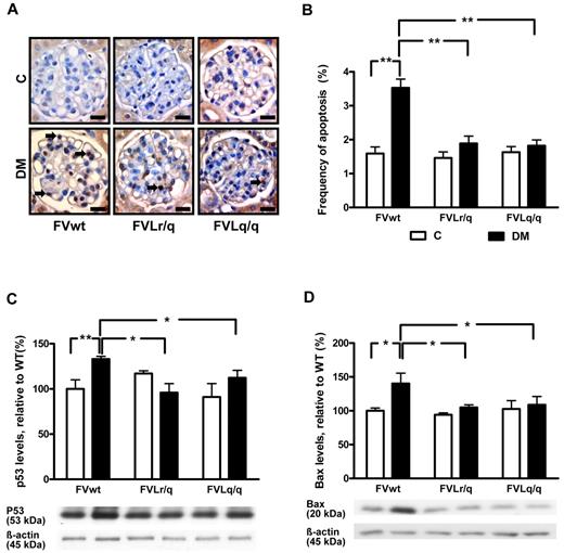 Figure 2. Reduced glomerular apoptosis in FVL mice. (A-B) Frequency of apoptosis in glomeruli as determined by TUNEL assay. Apoptosis was more frequent in glomeruli of diabetic wild-type mice (FVwt, arrows) than in diabetic heterozygous (FVLr/q, DM, arrows) or homozygous (FVLq/q, DM, arrows) FVL mice. Exemplary images of TUNEL stain (A) and bar graph (B) summarizing results. Brown indicates TUNEL-positive cells detected by HRP-DAB reaction; blue, hematoxylin counterstain; n ≥ 7 for each group. (C-D) Expression of apoptosis regulators in renal cortex extracts. Bar graph (top) and representative immunoblot (bottom) showing p53 (C) and Bax (D) expression in renal cortex tissue samples summarizing results (n ≥ 7 for each group). Scale bar indicates 15 μm (A). C indicates nondiabetic, control mice (white bars); DM, diabetic mice (black bars); means ± SEM are shown; *P < .05; **P < .01 (ANOVA).