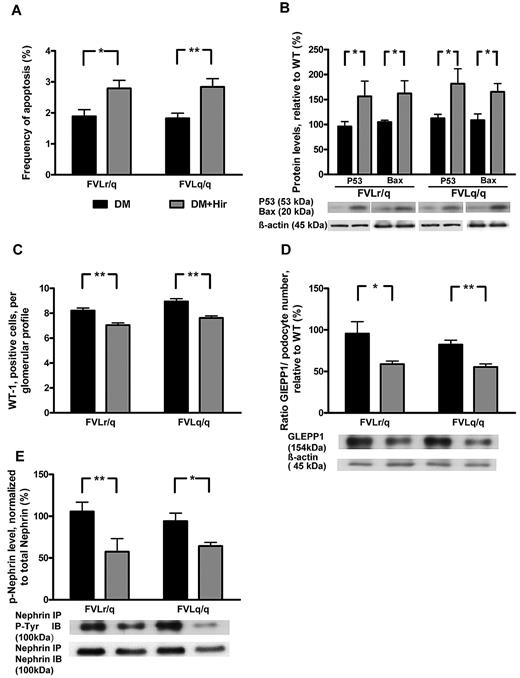 Figure 7. Hirudin treatment abolishes podocyte protection in diabetic FVL mice. (A) Bar graph summarizing frequency of apoptotic glomerular cells. (B) Expression of apoptosis regulators in renal cortex tissue samples of diabetic mice without or with hirudin treatment. Bar graph (top) and representative immunoblot (bottom) showing p53 and Bax expression (n ≥ 7 each group). (C) Podocyte number in glomeruli of diabetic mice without or with hirudin treatment as determined by WT-1 immunohistochemical staining. (D) Bar graph (top, data normalized for podocyte numbers) and representative immunoblot (bottom) showing GLEPP1 expression in renal cortex tissue samples of diabetic mice without or with hirudin treatment. Actin immunoblot is shown as loading control (n ≥ 7 each group). (E) Bar graph (top) and representative immunoblots of immunoprecipates (bottom) showing nephrin tyrosine phosphorylation in renal cortex tissue extracts of diabetic mice without or with hirudin treatment (n ≥ 7 each group). DM indicates diabetic mice (black bars); DM + Hir, diabetic mice with hirudin treatment (gray bars); *P < .05; **P < .01 (t test).