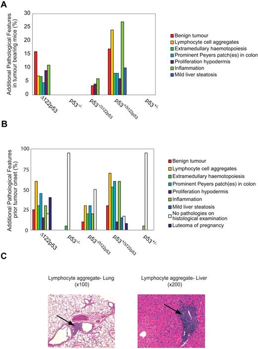 Figure 6. The Δ122p53 allele is associated with nonmalignant proliferative pathologies and inflammation. The 8 most common additional pathologies found with the Δ122p53 allele are listed with their corresponding frequencies compared with other genotypes. Pathologies were identified from hematoxylin and eosin-stained tissue sections. (A) Additional pathologies in the tumor cohorts from Figure 5. Mice that developed DLBCLs and DLBCL-like lymphomas are not included. (B) Additional pathologies in mice killed before tumor development (5-7 weeks old: Δ122p53, p53−/Δ122p53, and p53−/−; 7-10 months old: p53+/Δ122p53 and p53+/−); female mice in the breeding cohort that developed luteoma were killed. Results were from 20 Δ122p53, 10 p53−/Δ122p53, 20 p53−/−, 30 p53+/Δ122p53, and 20 p53+/− mice. (C) Photomicrographs of hematoxylin and eosin-stained sections show lymphocyte aggregations in the lung and liver present in Δ122p53 mice. Magnifications are indicated. Photomicrographs were taken with a Zeiss Axioplan Universal Microscope with 10×/0.3 and 20×/0.8 objective lenses. Images were captured using a SPOT Camera (SP 6.0) and Software Version 4.6.1. Images were cropped using Photoshop Version CS2 (Adobe).