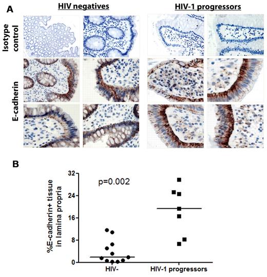Figure 4. Distribution of E-cadherin in the gastrointestinal mucosa. Pinch biopsies from the colon of 11 HIV-1 negative and 7 chronically infected HIV-1 subjects with progressive disease not on ART were obtained and stained for E-cadherin by immunohistochemistry (brown) and counterstained with hematoxylin. (A) Four representative immunohistochemical stainings from the intestine of HIV-negative and chronic untreated HIV-1+ subjects along with staining with an isotype control. E-cadherin in normal human colon is primarily localized to the mucosal epithelium and epithelial basement membrane, whereas redistribution of E-cadherin is visible in the lamina propria of HIV-1–infected subjects. Quantitation of E-cadherin staining was performed on 5 representative regions of the lamina propria from each section. The horizontal lines at each variable indicate the mean (B). The area of positive E-cadherin staining in the lamina propria was quantitated and found to be significantly higher in subjects with HIV-1 infection than in HIV-1–uninfected subjects (P = .002).