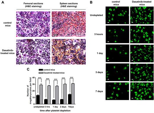 Figure 4. Dasatinib induces an increased number of mature MKs in BM and spleen. (A) Representative longitudinal sections of whole murine femurs and spleens stained with H&E from control mice and dasatinib-treated (5 mg/kg/d) mice for 7 days (scale bar = 50 μm). (B) Representative longitudinal sections of whole murine femurs from control mice compared with dasatinib-treated (5 mg/kg/d) mice that are undepleted versus platelet depleted after immune-induced thrombocytopenia by anti-GPIbα antibody (2 μg/g body weight) at various time points. MKs were identified by anti-mouse GPIIb-FITC antibody (scale bar = 20 μm). (C) Quantification of the number of MKs in the BM from control and dasatinib treated-mice that are undepleted versus platelet depleted. The average number of MKs per field was determined in GPIIb-stained BM sections throughout the length of 3 femurs; ***P < .005.