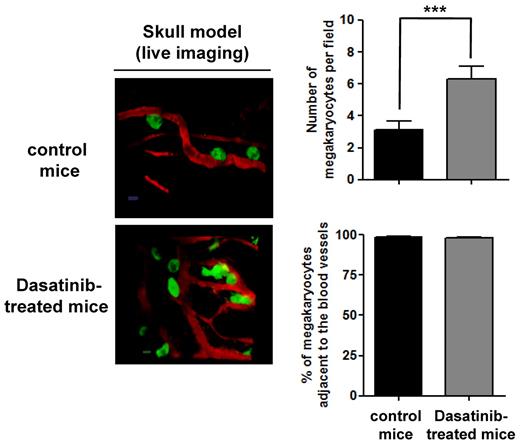 Figure 7. Localization of MKs in BM of dasatinib-treated mice. Localization of MKs in vivo was visualized by 2-photon intravital microscopy using mouse skull BM. The MKs (green) were identified using CD41-YFPki/+ mice in which enhanced YFP was expressed as a targeted transgene from the endogenous gene locus for CD41, a MK- and platelet-specific integrin. BM vasculature (red) was visualized by injection of TRITC-dextran (2 MDa) immediately before imaging. The average number of MKs per field and the percentage of MKs adjacent to the BM vasculature were determined in control CD41-YFPki/+ mice compared with dasatinib-treated mice (scale bar = 20 μm); ***P < .005.