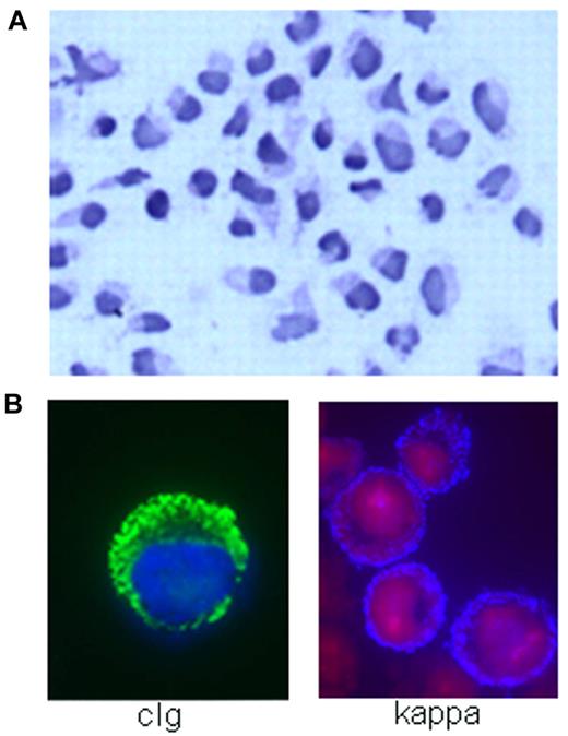 Figure 2. MWCL-1 cell line morphology. (A) Hematoxylin and eosin staining demonstrating the heterogeneity of the WM tumor clone represented in MWCL-1 cells, including B lymphocytes, lymphoplasmacytic cells, and mature plasma cells (original magnification ×200, Olympic Provus AX70 microscope). (B) Immunofluorescence showing the presence of κ-light chain on the extracellular surface of MWCL-1 cells and cytoplasmic IgM.
