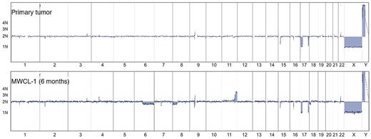 Figure 4. Whole-genome aCGH profiles. Comparative chromosomal CNAs in the original WM patient sample and the established MWCL-1 cell line at a 6-month passage. Note the common CNAs on chromosome 17 between all samples. Chromosomes 1 through 22, X, and Y, from p to q arm, are plotted on the x-axis from left to right. The predicted number of copies of each gene is indicated to the left of each panel.