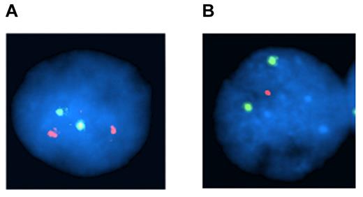 Figure 6. MWCL-1 cells retain both copies of chromosome 6q but exhibit monoallelic expression of mutated TP53. (A) Representative FISH image of MWCL-1 cells at a 12-month passage confirming the absence of a 6q deletion. Two hybridization signals are observed for both the probe specific to the centromere of chromosome 6 (green signal), and the locus-specific, c-MYB probe (red signal). (B) Representative FISH image of MWCL-1 cells at a 12-month passage demonstrating monoallelic loss of TP53. Two hybridization signals are observed for the probe specific to chromosome 17 (green signal), but only one signal is observed for the locus-specific, TP53 probe (red signal).