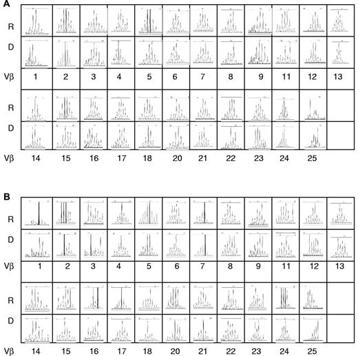 Figure 3. Representative TCRVβ spectratype from a pair of recipient and donor pair at SCT. The spectratype profiles of the 23 Vβ subfamilies were analyzed. Shown are the CDR3 lengths on the x-axis versus the fluorescence intensity in the y-axis. R indicates recipient; D, donor. (A) CD4+ cells. (B) CD8+ cells.