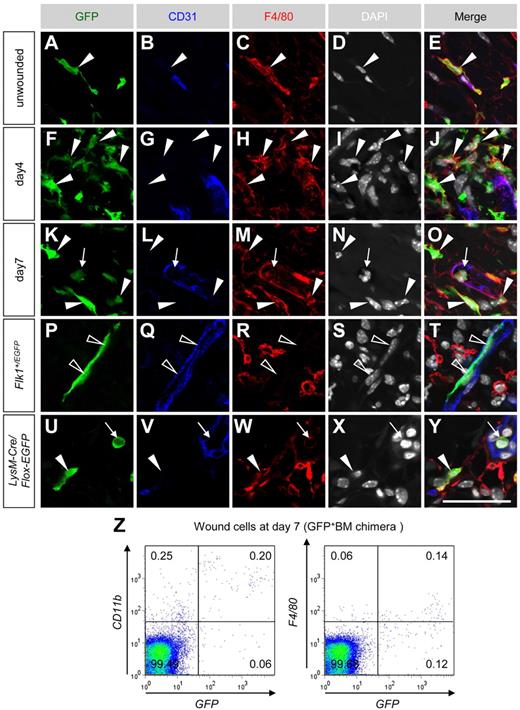 Figure 2. A major proportion of BMDCs recruited into wound tissues are macrophages in dorsal excisional wounds. (A-O) Sectional immunohistochemistry for indicated antibodies in unwounded and wounded tissues of mice reconstituted with GFP+ bone marrow cells. Most GFP+ cells located perivascularly (closed arrowheads) or in the vascular lumen (arrows) expressed F4/80. (P-Y) Sectional immunohistochemistry for the tissues 7 days after wounding in Flk-1+/EGFP mice (P-T) or LysM-Cre/Flox-CAT-EGFP mice (U-Y). GFP was detected only in endothelial cells of Flk-1+/EGFP mice (open arrowheads) and F4/80+ monocytes (arrows)/macrophages (closed arrowheads) of LysM-Cre/Flox-CAT-EGFP mice. (Z) FACS analysis for dissociated cells in wound tissues at day 7 indicated that approximately 70% of GFP+ cells are positive for CD11b, but F4/80 expression in FACS was weak and highly variable. Bar represents 50 μm.