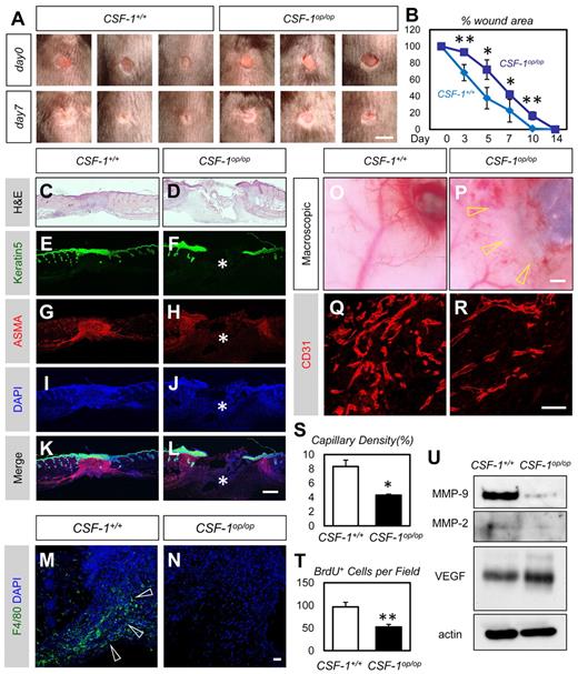 Figure 6. Decreased neovascularization in the wound area of CSF-1op/op mice. (A) Representative macroscopic views of full-thickness excisional wounds in the back skin of CSF-1+/+ or CSF-1op/op mice. Note delayed wound closure in CSF-1op/op mice. (B) Percentage of wound closure of dorsal excisional wounds (n = 6). (C-L) Hematoxylin and eosin staining (C-D) or immunohistochemistry of Keratin5 (green), α-smooth muscle actin (red), and 4,6-diamidino-2-phenylindole (blue) (E-L) in the healing edges at 7 days after wounding. Note delayed epidermal closure (E-F) and dermal contraction (G-H) in CSF-1op/op mice (asterisks). (M-N) Immunohistochemistry of F4/80 (green) and 4,6-diamidino-2-phenylindole (blue) in the healing edges at 7 days after wounding. Macrophages are abundantly recruited in the healing edge of CSF-1+/+ (arrowheads) but not in that of CSF-1op/op mice. (O-P) Representative macroscopic views of the ventral sides of the dorsal excisional wounds in CSF-1+/+ or CSF-1op/op mice (7 days after wounding). Note decreased vessels in the wound area of CSF-1op/op mice. (Q-R) Images for sectional immunohistochemistry of CD31. Neovascularization is decreased in the wound area of CSF-1op/op mice compared with that of CSF-1+/+ mice. (S-T) Quantification in the capillary density or the number of BrdU+ cells in the healing edges 7 days after wounding (n = 6). (U) Representative Western blotting for the wound tissues at 7 days after wounding. Although VEGF expression was not altered, MMP-9 and MMP-2 were down-regulated in CSF-1op/op mice. Bars represent 5 mm in A; 500 μm in C-L,O-P; and 50 μm in M-N,Q-R. *P < .05. **P < .01.