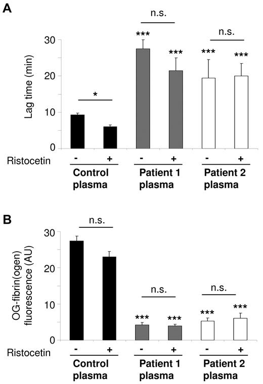 Figure 5. Role of plasma VWF in platelet fibrin formation under flow. Platelets were superfused with pooled plasma from control subjects (control) or from 2 patients with VWD at shear rate of 250 s−1. Ristocetin (37.5 μg/mL) was added as indicated. Microscopic images were taken at start and after 60 seconds of fibrin formation. (A) Lag time to start of fibrin formation. (B) Quantification of OG488-fibrin(ogen) binding. Means ± SE; n = 3-4; *P < .05, ***P < .001 vs control plasma.