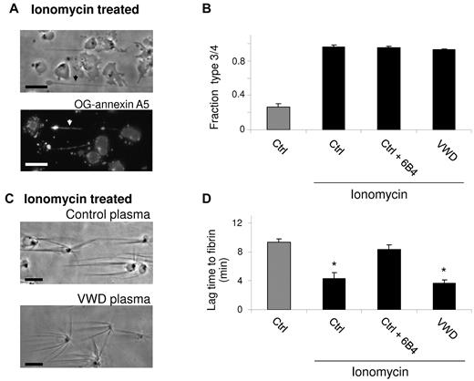 Figure 7. Rapid fibrin formation on ionomycin-stimulated platelets. Adhered platelets were prestimulated with ionomycin (10μM) and CaCl2 (1mM), then perfused with control plasma (Ctrl) or plasma from a patient with VWD in the presence or absence of 6B4 mAb (10 μg/mL). (A) Representative phase contrast and OG–annexin A5 fluorescence images (Nikon Diaphot 200 microscope, see “Methods”) after ionomycin stimulation (bars, 10 μm). (B) Fractions of type 3 and 4 (procoagulant) platelets before plasma perfusion. (C) Platelet-dependent fibrin formation after 240 seconds. (D) Lag time to fibrin formation after plasma perfusion. Means ± SE; n = 3-4.
