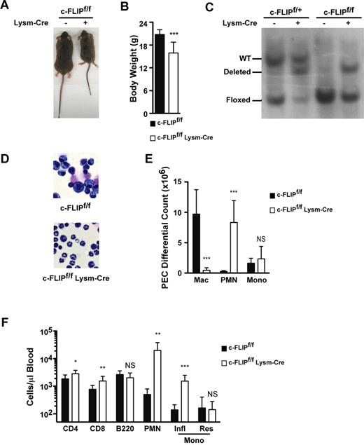 Figure 2. Loss of macrophages in c-FLIPf/f LysM-Cre mice. (A) Representative c-FLIPf/f and c-FLIPf/f LysM-Cre mice show the decreased size observed in c-FLIPf/f LysM-Cre mice. (B) Body weight of c-FLIPf/f and c-FLIPf/f LysM-Cre mice at 6-8 weeks of age. Black bars represent c-FLIPf/f mice and white bars represent c-FLIPf/f LysM-Cre mice. Data were obtained in 4 independent experiments (n = 7-9; ***P < .001). (C) Wild-type, floxed, and deleted c-FLIP alleles in BMDM from c-FLIPf/+, c-FLIPf/f, c-FLIPf/+ LysM-Cre, or c-FLIPf/f LysM-Cre mice as detected by Southern blot. Film was scanned with a Canon CanoScan n122ou scanner. (D) Cytospins of Day 3 thioglycollate-elicited PEC samples from c-FLIPf/f (left) and c-FLIPf/f LysM-Cre mice (right). Original magnification 200×. Images were obtained using a Zeiss Axiovert 200 (20×/0.20 NA objective lens) with an AxioCam MRC camera and AxioVision Rel. 4.8 software. (E) Quantification of macrophages, neutrophils, and monocytes in Day 3 thioglycollate-elicited PEC. Data were obtained in 4 independent experiments (n = 5-6; NS, not significant; ***P < .001). (F) Absolute numbers of CD4+ or CD8+ T cells, B220+ B cells, CD11b+Ly6Cint neutrophils, SSCloCD11b+Ly6Chi inflammatory monocytes, and SSClo CD11b+ Ly6Clo resident monocytes in peripheral blood as determined by flow cytometry. Data were obtained in 7 independent experiments. n = 8-10; NS, not significant; P < .05; **P < .01; ***P< .001. Error bars represent standard deviations.