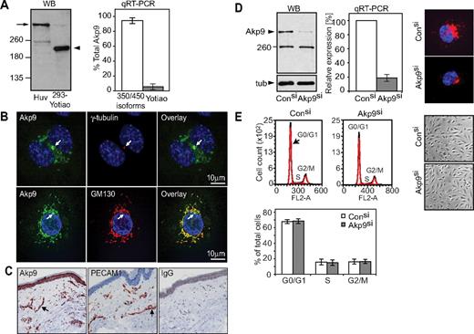 Figure 1. Analysis of AKAP9 350/450 expression in human ECs and characterization of cell cycle in AKAP9-depleted cells. (A) Left panel, Western blotting (WB) of AKAP9 in HUVEC lysate and 293 cells transfected with Yotiao (293-Yotiao). A single band at the predicted molecular weight for AKAP350/450 long isoform(s) (arrow) was observed in HUVECs. The lower 250-kD immunoreactive band in HUVECs did not migrate at the position of recombinant Yotiao in 293 cells (arrowhead). Right panel, qRT-PCR of HUVECs using primers that recognize the long isoforms (350/450 isoforms) or Yotiao was undertaken and their relative abundance (percentage of total AKAP9) was calculated. n = 4. (B) Confocal analysis of HUVECs stained with antibodies to the indicated proteins and DAPI (nucleus stain) followed by overlay of the images. AKAP9 (Akp9) codistributed with γ-tubulin, a centrosomal marker (top panel, arrow), and colocalized with GM-130, a cis-Golgi marker that is perinuclear and excludes the centrosome (bottom panel, arrow). Bar = 10 μm. (C) Tissue sections of human skin were stained with rabbit anti-Akp9, anti–PECAM-1 or rabbit IgG. AKAP9 was present in the large and small vessels (arrow) of the skin in a pattern coincident with an endothelial cell marker, PECAM-1, and in the epithelium. No specific staining was observed with IgG. (D) HUVECs were transfected with AKAP9 (Akp9) or Control (Con) siRNA duplexes (si), and evaluated 48 hours later for AKAP9 expression. Left panel, AKAP9 protein level was analyzed by Western blotting. The lower 250-kDs protein remained upon AKAP9 silencing, suggesting that it is a nonspecific, immunoreactive band. Middle panel, AKAP9 message was quantitated by qRT-PCR using oligonucleotides for long isoforms 350/450 kDa. Right panel, AKAP9 protein was assessed by immunofluorescence staining. (E) Representative cell-cycle profiles by fluorescence-activated cell sorting analysis of DNA content. Top left panel, AKAP9 silencing does not alter the distribution of cells in the different phases of the cell-cycle compared with control siRNA cells. Bottom left panel, an average of results from 3 independent experiments are given. Right panels, phase contrast images of control and AKAP9-silenced monolayers revealed an intact monolayer and cells that were morphologically similar in both cultures.
