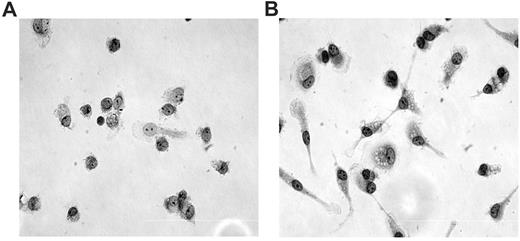 Figure 1. Monocyte morphology. Monocytes were cultured with medium and 10% fetal calf serum over slide glass for 5 days at 37°C with 5% CO2. After that, cells were stained with a PanOptic kit. (A) Monocytes obtained from noninfected donors; (B) monocytes obtained from HTLV-1–infected donors. Original magnification ×40 objective, visualized under inverted phase-contrast microscopy.