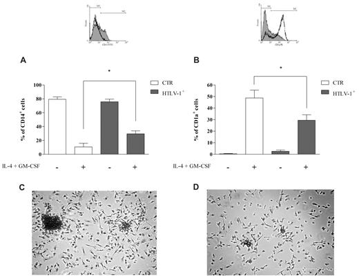 Figure 2. Monocytes from HTLV-1–infected individuals have a reduced capacity for DC differentiation in vitro. Cells were incubated with or without IL-4 plus GM-CSF (50 ng/mL) for 5 days at 37°C in a 5% CO2 atmosphere. After this period, CD14 and CD1a expression was analyzed by flow cytometry. Data in bars are expressed as the percentage of CD14+ cells (A) or CD1a+ cells (B). Open bars represent cells obtained from noninfected donors (CTR; n = 8), and shaded bars represent cells obtained from HTLV-1–infected donors (n = 12). Data are mean ± SD of 8 independent experiments. *Significantly different from control (P < .05). (Inset) Representative experiment showing CD14 and CD1a expression patterns in cells from noninfected donors (white) and HTLV-1–infected donors (gray; region M2 comprises positive cells). Cells were stained with a PanOptic kit. (C) Monocytes obtained from noninfected donors cultivated with IL-4 plus GM-CSF; (D) monocytes obtained from HTLV-1–infected donors cultivated with IL-4 plus GM-CSF. Original magnification ×20 objective, visualized under inverted phase-contrast microscopy.