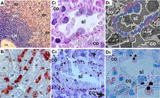 Figure 2. Structure-function correspondences in the slow, open microcirculation. (A) On human spleen sections, the medium-sized central artery (CA) is surrounded by white pulp (here, a lymphoid nodule; LN) made of densely packed white cells, between which no RBCs circulate. In the perifollicular zone (PFZ) that surrounds the white pulp, RBCs are visible within flat, concentric microcirculatory spaces. In the red pulp (RP), typical sinuses (S) are observed. RBCs engaged in the fast, closed circulation transit through the PFZ, whereas RBCs in the open microcirculation navigate slowly in the RP cords before returning to the blood vascular bed by crossing the wall of sinuses. Because direct by-passes exist between the PFZ and sinuses, sinus lumens (sl)—though located in the RP—collect both the fast (closed) and the slow (open) microcirculations (Giemsa-stained human spleen section ×400). (B) Macrophages account for almost half the volume of the cords (co), although approximately 10% of them can be found in the sinus lumen (sl, immunohistochemistry of an isolated-perfused human spleen section using an anti-CD68 primary antibody revealed with a peroxidase secondary antibody, ×400). Because the RP accounts for 75% of spleen volume, an average 150-g human spleen contains approximately 50 g (or 50 mL) of macrophages (ie, approximately 100 times greater than the average 0.5-mL volume of monocytes circulating in the vascular beds). (Ci) The visualization of sinus walls on histologic sections is facilitated by PAS (phosphatase acid shift) staining that highlights the peculiar basal fibers of sinuses, providing a clear separation between cords (co) and sinus lumens (sl) (isolated-perfused human spleen ×1000). The sinus wall is made of elongated endothelial cells surrounded by helical basal fibers. (Cii) In a patient treated with artemisinin derivatives, if the parasite load is high, parasite remnants either pitted from their host RBCs or retained with their host RBC delineate the abluminal side of the sinus wall (D1, PAS-stained post mortem spleen sample, ×400). (Di) On transmission electron microscopy (TEM), the periodic disposition and homogenous aspect of basal fibers (pseudocolored purple), as well as elongated shape of sinus endothelial cells (pseudocolored blue), allows an accurate orientation (isolated-perfused human spleen, ×2000). (Dii) When pitted from an RBC squeezing through an inter endothelial slit in a sinus wall, P falciparum remnants are deposited on the abluminal side of the sinus (PAS-stained section of an isolated-perfused human spleen challenged with artesunate-exposed P falciparum–infected RBCs, ×1000, inset ×2000). These observations confirm that pitting occurs exclusively or very predominantly, whereas RBCs cross the sinus wall and illustrates the unidirectional aspect of sinus wall crossing by RBCs—from cords to sinus lumen.