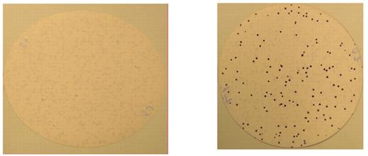 Figure 7. A representative example demonstrating a humoral immune response against RGS19 in response to vaccination. Sera from patient number 10 was obtained before vaccination (left panel) and 1 month after vaccination (right panel) and incubated with E coli transfected with phage expressing myeloma-derived cDNA. Specific binding of antibody to recombinant proteins expressed on the lytic plaques was detected by incubation with alkaline phosphatase–conjugated goat anti–human IgG antibody. Antigen-antibody complexes were visualized by staining with 5-bromo-4-chloro-3-indolyl phosphate and nitro blue tetrazolium. Vaccination induced an antibody response directed against RGS19.