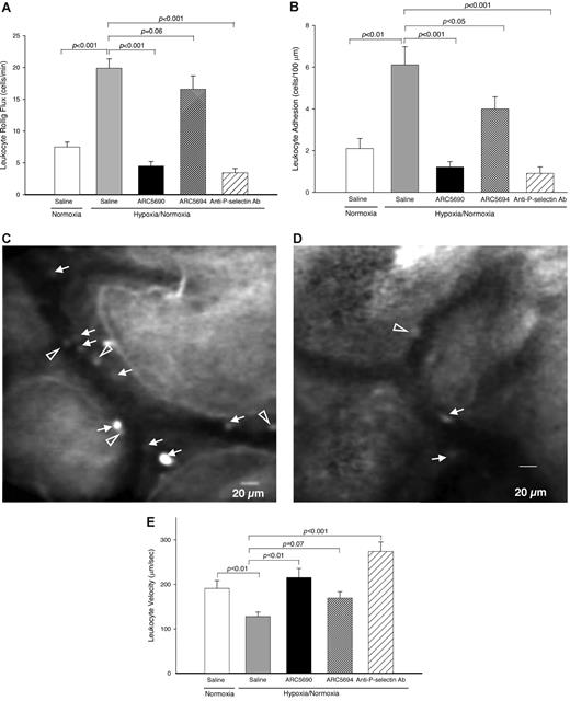 Figure 5. Anti–P-selectin aptamer ARC5690 decreases leukocyte rolling flux and leukocyte adhesion. (A) ARC5690 decreases leukocyte rolling flux. Leukocyte rolling flux was determined by the number of cells rolling through a fixed point per minute (cells/min). Compared with saline-treated mice, pretreatment of SCD mice with ARC5690 (P < .001), but not with ARC5694 (P = .06), decreased leukocyte rolling flux under hypoxia/normoxia stress. (B) ARC5690 decreases leukocyte adhesion to endothelial cells. Leukocyte adhesion was quantified by counting the number of adherent cells (stationary for > 30 seconds) in a 100-μm length of the vessel. Pretreatment with ARC5690 before hypoxia/normoxia stress reduced the number of adherent leukocytes compared with saline-treated mice (P < .001). Scrambled aptamer ARC5694 showed some inhibition of leukocyte adhesion (P < .05; see “Discussion”). (C-D) Frame-captured images from videotaped intravital microscopy of bone marrow venules in SCD mice injected with saline (C) and ARC5690 (D) after infusion of PE rat anti–mouse CD45. Saline-treated mice show a higher number of adherent (white arrows) and rolling (open arrowheads) leukocytes. (E) ARC5690 improves velocities of free-flowing leukocytes. Velocities of free-flowing leukocytes were determined using Image Pro-Plus 5.0 software. Five to 8 velocity measurements were performed along the centerline of the vessel and used to calculate hemodynamic parameters. Velocity of free-flowing leukocytes increased after treatment with ARC5690 but not with the scrambled aptamer ARC5694 compared with saline treated mice. Values were mean ± SE obtained from 4 to 5 mice in each group. The number of venules in experimental groups ranged from 18 to 21. P values for statistical analyses are shown on top of the figures.