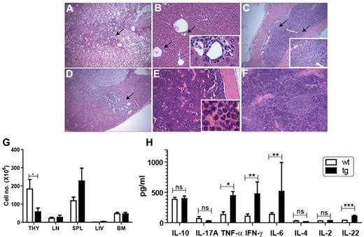 Figure 2. The IL-22R1 transgenic founders show spontaneous multiorgan inflammation. Various organs of IL-22R1 tg mice were stained (hematoxylin and eosin) and examined under the microscope. Inflammation was observed in lung (×20; A), liver (×20; B), colon (×20; C), and kidney (×20; D). Hyperplasia with granulocytic infiltrates was observed in bone marrow (×20; E) and extramedullary hematopoiesis was seen in spleen (×20; F). Arrows show leukocytic infiltrates, and insets show enlargement of the portion of the slide. (G) Total cellularity of the thymus, lymph nodes, bone marrow, spleen, and liver from IL-22R1 tg mice (n = 3) and littermate controls (n = 3). (H) Expression of proinflammatory cytokines is elevated in IL-22R1 tg mice. Cytometric bead array to assay the concentrations of an inflammatory panel of cytokines in the serum of IL-22R1 (n = 7) tg founders and nontransgenic littermates (n = 9). IL-22 production in the serum of IL-22R1 tg and wt mice measured by ELISA (n = 6). The data are represented as the mean ± SEM. *P < .05, **P < .01, ***P < .001; ns, not significant. Images were acquired with an Olympus BX40 light microscope using Image Proplus 6 software.
