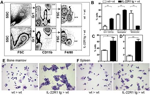 Figure 4. IL-22R1 tg mice exhibit neutrophilia. (A) Forward scatter/side scatter plot shows that the percentages of GR1+CD11b+ population was higher in IL-22R1 tg mice compared with the wt mice. The Gr1+CD11b+ population was further distinguished based on the FSC and F4/80 gates. (B) Percentage of neutrophils (FSChiF4/80lo) and monocytes (FSC loF4/80int) from polymorphonuclear leukocytes. (C-D) Percentage of cells that are Gr1+CD11b+ in bone marrow and spleen (n = 3), respectively. (E-F) Representative cytospins of 1 × 104 cells from bone marrow (×20; E) and spleen (×20; F) stained with Giemsa. Images were acquired with an Olympus BX40 light microscope using Image Proplus 6 software.