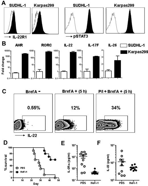 Figure 7. ALK+ALCL cell line characterization and leukemia model amplify IL-22, which correlates with tumor burden. (A) Histogram of flow cytometric analysis of cell lines stained for IL-22R1 and pSTAT3 (Tyr705) antibodies. (B) Relative quantification of AHR, RORC, IL-22, IL-17F, and IL-26 by real-time polymerase chain reaction. (C) Zebra-plot of flow cytometry data showing intracellular levels of IL-22 with (Bref A +) or without (Bref A −) Brefeldin A, and PMA and ionomycin stimulation with Brefeldin A (P/I+ Bref A +) for 5 hours. (D) Kaplan-Meier survival plot of the Karpas299 leukemia-bearing SCID/NOD mice injected with PBS or HeFi-1. Serum levels of sIL-2Rα (E) and IL-22 (F) in Karpas299 leukemia-bearing SCID/NOD mice at day 21 after therapy.