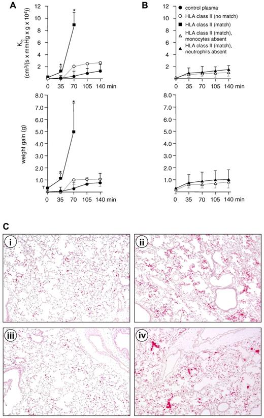 Figure 5. HLA class II antibodies induce TRALI in an ex vivo rat lung model in the presence of human neutrophils and matched human monocytes. (A) In the presence of neutrophils, HLA class II antibodies and monocytes that do not bear cognate antigen(s), a minor increase in the capillary filtration coefficient (Kfc) and lung weight is observed (○), but this increase is not different from results obtained with control plasma (●). In contrast, the presence of the same antibodies, neutrophils, but matched monocytes, leads to a significant increase in Kfc and lung weight after 35 minutes and severe edema after 70 minutes (■; P < .01). (B) The effect obtained with plasma, matched monocytes, and neutrophils can be abolished if human monocytes (▵) or human monocytes (▴) are not added to the circulation; n = 3 for each experiment. Results are given as mean values ± SD. (C) Clustering of leukocytes (red) in pulmonary capillaries after the addition of monocyte supernatant or plasma containing HLA class II antibodies to the perfusion circuit (hematoxylin and eosin and antimyeloperoxidase staining). If rat lungs were perfused with human neutrophils and supernatant from monocyte cultures incubated with plasma containing either unmatched (i) or matched (ii) HLA class II antibodies, leukocyte clustering is only observed after the addition of matched supernatant (ii). If rat lungs were perfused with human neutrophils, monocytes, and human plasma containing HLA class II antibodies that either were unmatched (iii) or matched (iv) to the circulating monocytes, clustering of leukocytes is only observed in the presence of matched HLA class II antibodies (iv).