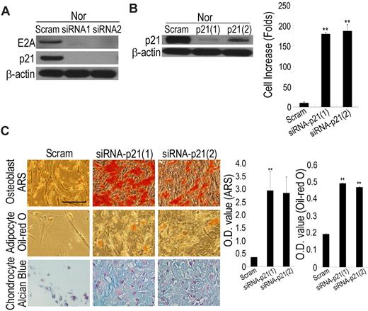 Figure 5. Hypoxia or HIF-TWIST increases stem cell properties via suppressing p21. (A) siRNA against E2A in normoxic cells decreases the expression of p21. (B) siRNA against p21 in normoxic cells increases cell growth. Normoxic cells were cultured 12 days after p21 knockdown in low-density culture and cell numbers were counted. (C) Normoxic cells at passage 6 were stably transfected with scrambled or p21 siRNA, followed by differentiation into osteoblasts, adipocytes and chondrocytes for 3 weeks, and achievements of differentiation were analyzed by staining with ARS, Oil Red O and Alcian Blue, respectively. OD values of ARS and Oil Red O were analyzed for quantifying osteoblast and adipocyte differentiation, respectively. Knockdown of p21 increases the differentiation potential to osteoblasts, adipocytes and chondrocytes. Bar = 50 μm.