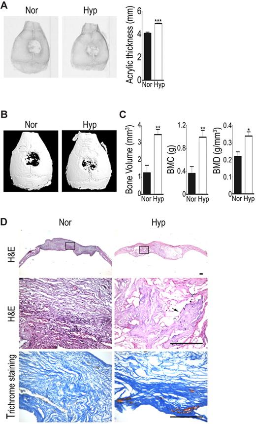 Figure 7. Hypoxic cells increase in vivo bone repairing ability. Calvarial defects were implanted with hypoxic (Hyp) or normoxic cells (Nor). (A) Radiographic images and densitometric analysis were performed at 6 weeks. (B) Micro-CT 3D reconstruction imaging and (C) quantitation for bone volume, bone mineral content (BMC), and bone mineral density (BMD) of newly formed tissues were performed at 6 weeks. The data are expressed as mean ± SEM. Asterisks indicate significant differences: *P < .05, **P < .01, ***P < .005. (D) Samples were harvested for histologic analysis 6 weeks later. Hematoxylin and eosin staining (H&E) for morphologic evaluation (the rectal angle area in the top panel is magnified in the middle panel) and Mallory trichrome staining for collagen deposition in hypoxic and normoxic groups. Photomicrographs were captured using an Olympus AX80 microscope equipped with a Qimaging QiCam digital camera (Qimaging). Original magnifications, 2×/0.13 NA dry objective (top), 20×/0.7 NA dry objective (middle and bottom). Arrow indicates bone area. Bar = 100 μm.