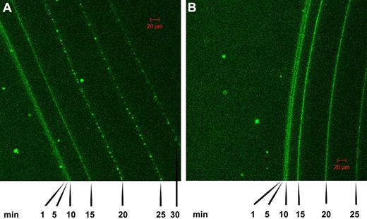Figure 4. Confocal microscopy showing a time course of lysis of fibrin clots formed using high and low thrombin concentrations in the presence of tPA-GFP. (A) The pattern of tPA binding and fibrin lysis as the fibrin front recedes for fibrin formed using 5nM thrombin (fibrin5). (B) The same time course for fibrin formed at 100nM thrombin (fibrin100). Images were taken at the indicated time after the addition of tPA-GFP, and the green channel components of the sequential frames were overlaid in a single image for presentation purposes. A characteristic granular pattern of fluorescence can be seen at the lysis front in fibrin5, whereas in fibrin100 the tPA-GFP is distributed more homogeneously.