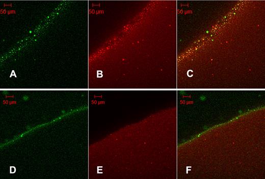 Figure 5. Colocalization of tPA-GFP with fibrin protein aggregates. Orange-labeled fibrinogen was clotted with thrombin at 5nM (A-C, fibrin5) or 100nM (D-F, fibrin100) and fibrinolysis initiated with the addition of tPA-GFP. After 35 minutes of lysis, micrographs were taken of green fluorescence (A,D) and red fluorescence (B,E). (C,F) Overlays of the corresponding single fluorescent micrographs for each fibrin type. Fibrin5 shows the granular pattern of fibrin aggregates noted previously, which can be seen to bind tPA. (C) Overlay also shows a number of green particles of precipitated tPA-GFP. Fibrin100 displays a narrow zone of bound tPA and few fibrin aggregates.