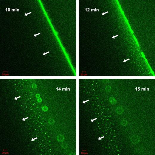 Figure 6. Progress of fibrinolysis in fibrin5 formed using 5nM thrombin with delF-tPA-GFP. The 4 panels are snapshots of the distribution of delF-tPA-GFP during fibrinolysis at the times indicated in the upper corner. Initial binding and concentration of the delF-tPA-GFP to the surface of the clot were slow, but after 10 minutes a narrow zone of concentrated activator formed. Subsequently, some tPA diffused ahead of the fibrin-buffer interface and was associated with some fibrin aggregates; a proportion of delF-tPA-GFP also remained close to the fibrin-buffer interface appearing as a “starburst” pattern.