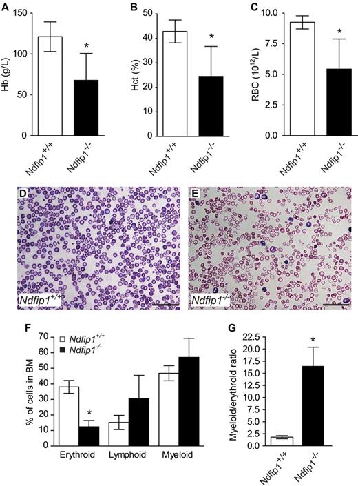 Figure 4. Ndfip1−/− mice fed a low-iron diet develop hypochromic, microcytic anemia. (A) Hemoglobin (Hb), (B) hematocrit (Hct), and (C) RBC count are decreased in Ndfip1−/− mice compared with Ndfip1+/+ mice. Blood smears from (D) Ndfip1+/+ mice and (E) Ndfip1−/− mice show RBCs from Ndfip1−/− mice are microcytic and hypochromic compared with their wild-type counterparts. Scale bar, 50 μm. (F) Erythroid, lymphoid, and myeloid series as a percentage of total cells in the bone marrow smears. (G) The myeloid to erythroid ratio in bone marrow. The percentage of erythroid series cells is decreased in Ndfip1−/− mice, and the myeloid to erythroid ratio is increased, indicating impaired erythropoiesis. Data represent mean ± SD, *P < .05, n = 4-7.