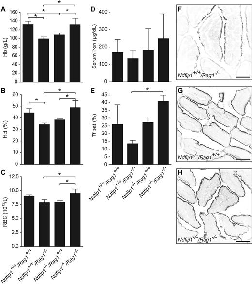 Figure 6. Removing inflammation reveals further evidence for the importance of Ndfip1 in the regulation of DMT1 in vivo. (A) Hb, (B) Hct, and (C) RBC count are significantly increased in Ndfip1−/−/Rag1−/− mice compared with single knockout Ndfip1+/+/Rag1−/− mice and Ndfip1−/−/Rag1+/+ and are restored to Ndfip1+/+/Rag1+/+ levels. (D) Serum iron and (E) transferrin saturation in (Ndfip1+/+/Rag1+/+) as for other genotypes Ndfip1−/−/Rag1+/+, Ndfip1+/+/Rag1−/−, and Ndfip1−/−/Rag1−/− mice. Both serum iron and transferrin saturation are elevated in the double knockout mice. DMT1 expression in the duodenum of (F) Ndfip1+/+/Rag1−/− mice, (G) Ndfip1−/−/Rag1+/+ mice, and (H) Ndfip1−/−/Rag1−/− mice. DMT1 levels are increased in mice lacking Ndfip1 (Ndfip1−/−/Rag1+/+ and Ndfip1−/−/Rag1−/− mice) compared with Ndfip1+/+/Rag1−/− controls. All mice were fed a low-iron diet for 3 weeks, data represent mean ± SD, *P < .05, n = 3-4.
