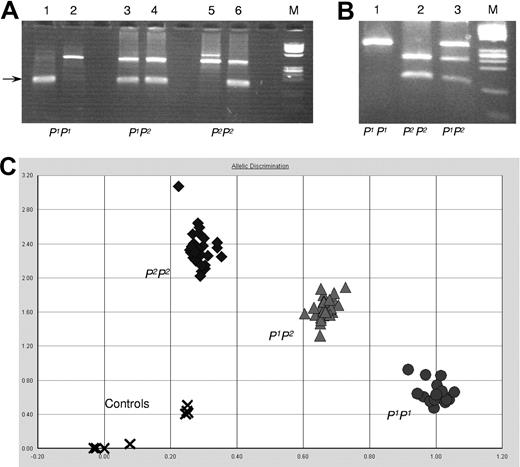 Figure 5. P1/P2 genotyping assays. (A) PCR-ASP: lanes 1, 3, and 5 show the P1-specific amplification, and lanes 2, 4, and 6 show P2-specific amplicons (size indicated by an arrow). The upper band is the JK blood group gene-derived control band present in both JK*A and JK*B and found in all individuals tested so far including those with the Jk(a-b-) phenotype. Lanes 1 and 2, a P1 homozygous sample; lanes 3 and 4, a P1P2 heterozygous sample; and lanes 5 and 6, a P2 homozygous sample. ϕX 174 DNA/HinfI was used as size marker (M). (B) PCR-RFLP: fragments amplified from exon 2a digested with NlaIII and run on a 4% agarose gel. Lane 1 shows the undigested P1P1 sample; lane 2 shows the fully digested P2P2 sample; and lane 3 shows the P1P2 sample with both digested and undigested fragments. ϕX 174 DNA/HinfI was used as size marker (M). (C) AD by the SNP genotyping assay: 25 samples to be typed and 3 control samples with known genotype (one with each genotype) were run in triplicate. Water was used as negative control (indicated by x). All samples clustered in 3 well-defined and separate areas (circles for P1P1; triangles for P1P2; and diamonds for P2P2 samples).