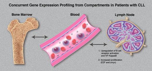 The tissue microenvironment directly affects the tumor biology of CLL cells in vivo. Variable gene expression signatures are observed within the same patients' CLL cells simultaneously obtained from marrow, blood, and lymph node compartments. (Professional illustration by Marie Dauenheimer.)