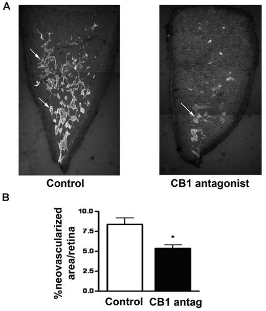 Figure 7. CB1 antagonism inhibits ocular pathologic angiogenesis. (A) Mice were treated with a single intraperitoneal injection of CB1 antagonist (0.7 mg/kg) from day P12 to P16 and were killed on day P17. New vessel tufts on the surface of retinas were stained using Isolectin GS-IB4. Overlaping photographs of the retinal segments were taken at 4× magnification and the individual images were combined as montages to reconstruct the entire retinal segment. (B) Values represent the mean ± SEM for n = 6 animals for each group (ANOVA, *P < .05, **P < .01 vs control).