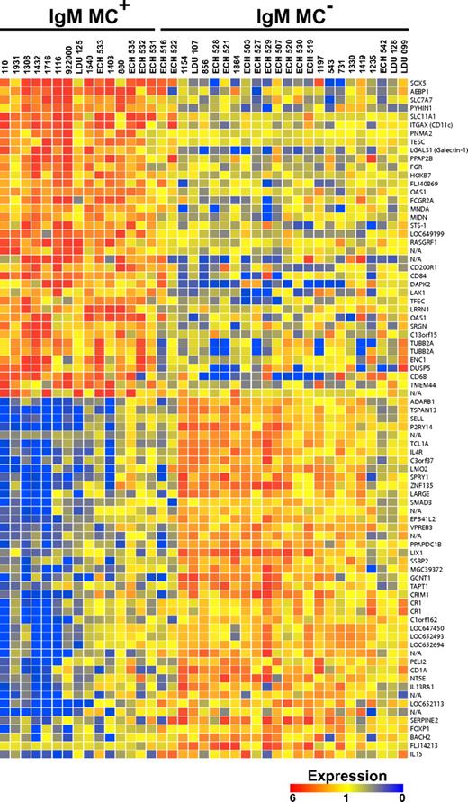 Figure 1. Transcriptome analysis of IgM+κ+CD27+ B cells. The transcripts differentially expressed by IgM+κ+CD27+ B cells from HCV+MC+ and MC− patients are displayed. Up- and down-regulated transcripts are indicated in red and blue, respectively. The magnitude of expression is indicated by the color bar.