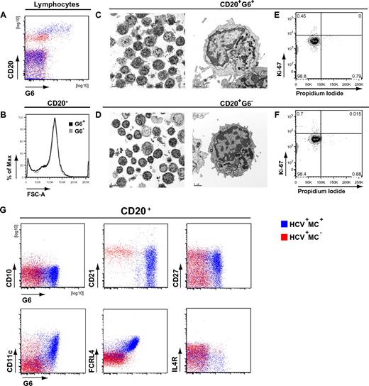 Figure 3. Phenotypic analysis of HCV+MC+ patients' clonal B cells. PBMCs from one HCV−MC− (ECH 542, red) and one HCV+MC+ patient (LDU 125, blue) representative of 6 samples each are shown. (A) Staining of PBMCs with anti-CD20 and G6 mAbs. (B) Forward light scatter analysis of G6+ and G6− B cells from the HCV+MC+ person. Scanning electron micrographs of immunomagnetically sorted G6+ and G6− B cells from the HCV+MC+ person. (C-D) Scale bars on the low and high power magnifications represent 5 μm and 1 μm, respectively. Propidium iodide and Ki-67 staining of immunomagnetically sorted G6+ and G6− B cells from the HCV+MC+ person for Ki-67 and propidium iodide (E-F). Staining for cell surface CD10, CD21, CD27, CD11c, FCRL4, and IL-4R (G). Electron micrographs (original magnification ×10 000) were taken with a FEI Tecnai G2 Spirit BioTWIN Transmission Electron Microscope equipped with a Gatan ES500W Erlangshen CCD camera and DigitalMicrograph Software.