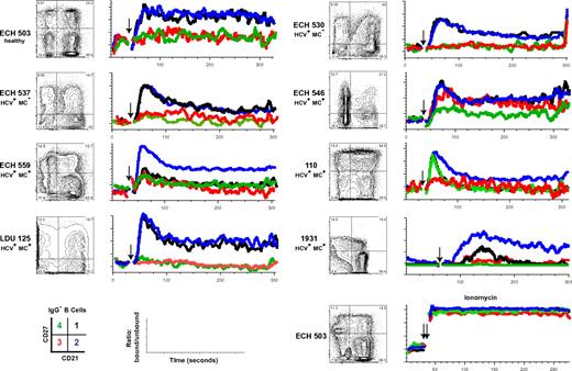 Figure 5. CD27+CD21low, compared with CD27+CD21high, B cells have attenuated Ca2+ responses after BCR cross-linking. Analyses of B cells from one healthy volunteer (ECH 503), 2 HCV+MC− patients (ECH 530 and ECH 537), and 5 HCV+MC+ patients (ECH 546, ECH 559, 110, LDU 125, and 1931) are shown. PBMCs from 1931 and LDU 125 were collected 4 and 10 months, respectively, after the cells collected for the microarray and primary immunophenotyping experiments. (Left panels) CD27 and CD21 staining of IgG− B cells. Indo-1-AM-loaded cells were stained with anti-CD19, anti-IgG, anti-CD27, and anti-CD21, warmed to 37°C, and, after establishing a baseline for 30 seconds, stimulated with 10 μg/mL goat F(ab′)2 anti–human IgM. Kinetic graphs represent ratios of bound/unbound Indo-1 over time for CD27+CD21high, CD27+CD21low, CD27−CD21high, and CD27−CD21low B-cell populations. Single arrows indicate injection of F(ab′)2 anti–human IgM; and double arrow, injection of 10 μg/mL ionomycin.