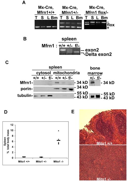 Figure 3. Deletion of Mfrn1 in adult mice leads to loss of Mfrn1 in hematopoietic tissues. Mfrn1flox/− mice were crossed to mice carrying Mx-Cre. At 3 weeks of age, mice (Mfrn1flox/−;Mx-Cre) were injected with poly(I:C) to induce Cre expression. The mice were analyzed 4-8 weeks later. (A) PCR analysis of Mfrn1 of genomic DNA from thymus (T), spleen (S), liver (L), and bone marrow (Bm) of mice with noted genotypes. (B) RT-PCR analysis of mRNA in the spleens of mice with the noted genotypes using primers specific to exon1 and exon4, which flank exon 2. A wild-type mRNA gave rise to a transcript amplification of 443 bp; a deletion of exon 2 at genomic level gave rise to a transcript amplification of 214 bp. (C) Western analysis of Mfrn1, porin, and tubulin in cytosol, mitochondria, and total bone marrow isolated from mice with the specified genotypes. (D) Bar graph of spleen weight/total weight of mice with the noted genotypes. (E). Hematoxylin and eosin–stained sections of spleen from Mfrn1+/+ mice and Mx-Cre–deleted Mfrn1−/− mice.