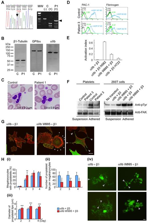 Figure 1. Platelet morphology and biochemical, genetic, and functional analyses of ITGA2B R995W mutation. (A; left) DNA sequence analysis of ITGA2B. The entire coding regions of the patients' ITGA2B were amplified from genomic DNA by the polymerase chain reaction, and amplified DNA fragments were subjected to direct cycle sequence analysis. A C to T transition at nucleotide 3077, changing Arg995 to Trp (R995W), was detected. Nucleotide numbering for ITGA2B cDNA is according to Poncz et al.18 The arrow shows the position of the substitution. (Right) Allele-specific restriction analysis. DNA fragments amplified using primers 2Bg305/303 (supplemental Table 1) were digested with BspACI (SibEnzyme), electrophoresed on 2% agarose gels, and stained with ethidium bromide. The 3077C > T substitution abolishes a recognition site for BspACI, generating a new 231-bp band (arrowhead). The mutation was not found in 108 healthy controls or in the SNP database (www.ncbi.nlm.nih.gov/SNP). MW indicates HaeIII digest of ΦX 174 DNA; C, control; and P1, patient 1. (B) Immunoblot analysis of platelets. Triton X-100-soluble platelet lysates were separated by sodium dodecyl sulfate-polyacrylamide gel electrophoresis on 4% to 12% gradient acrylamide slab gels (Invitrogen) and electroblotted onto polyvinylidine difluoride membranes. The blots were incubated with anti-β1 tubulin antibody NB2301,19 anti-GPIbα antibody PL524 (Takara), and anti-αIIb antibody SZ22 (Beckman-Coulter) and reacted with horseradish peroxidase-conjugated secondary antibody. The bound antibodies were visualized using an enhanced chemiluminescent substrate. C indicates control; and P1, patient 1. (C) Platelet morphology. Peripheral blood smears were stained with May-Grünwald-Giemsa for a normal control and patient 1 (original magnification, × 1000). The patient showed giant platelets with morphologically normal leukocytes. The number in each panel shows the mean platelet size (n = 200). Images were obtained using a BX50 microscope with a 100×/1.35 numeric aperture oil objective (Olympus). Images of the slides were acquired using a DP70 digital camera and DP manager software Version 1.2.1.107 (Olympus). (D) Activation state of platelet αIIbβ3. Washed platelets from patient 3 were resuspended in Tyrode buffer (137mM NaCl, 2.7mM KCl, 1.0mM MgCl2, 3.3mM NaH2PO4, 3.8mM N-2-hydroxyethylpiperazine-N′-2-ethanesulfonic acid, 0.1% glucose, 0.1% bovine serum albumin, pH 7.4) and incubated with fluorescein isothiocyanate-conjugated PAC-1 or 125 μg/mL fluorescein isothiocyanate-labeled fibrinogen in the presence or absence of 10μM FK633 (αIIbβ3-specific peptidomimetic antagonist: black lines) or 10μM adenosine diphosphate (blue lines), and analyzed by flow cytometry. Numbers indicate the mean fluorescence intensity. Results are representative of 2 independent experiments. (E) Quantitation of the αIIbβ3 activation state. The activation state of αIIbβ3 was quantified as an activation index on transiently transfected 293T cells. The activation index was higher for αIIb-W995 than for β3-H723 but was weaker than for an activating mutant β3-N562. Activation index = (a − b)/(c − b), in which a is the mean fluorescence intensity of PAC-1 binding with buffer, b is the mean fluorescence intensity in the presence of FK633, and c is the mean fluorescence intensity in the presence of PT25–2 (anti-αIIbβ3 antibody, which induces the active conformation of αIIbβ3). Data are mean plus or minus SE (n = 3). (F) FAK phosphorylation. Washed platelets from patient 3 (left) or transiently transfected 293T cells (right) were incubated in suspension or seeded onto 100-μg/mL fibrinogen-coated plastic dishes for 1 hour. Cells were washed with phosphate-buffered saline and lysed with 1% Triton X-100 and 1mM sodium vanadate. FAK was immunoprecipitated from the lysates with anti-FAK antibody FAK(C903; Santa Cruz Biotechnology) and protein G-Sepharose, and phosphotyrosine was detected with the antiphosphotyrosine antibody 4G10 (Millipore). Note that 300-μg and 150-μg lysates from suspension and adhered platelets, respectively, and 200-μg lysates from suspension and adhered transfected 293T cells were used for immunoprecipitation analysis. To monitor the loading of gel lanes, the membrane was stripped and reprobed with the anti-FAK antibody FAK(A17; Santa Cruz Biotechnology). Results are representative of 2 and 3 independent experiments for platelets and transfected cells, respectively. (G) Abnormal cytoplasmic protrusions in αIIb-W995/β3-transfected CHO cells. Stably transfected CHO cells were seeded onto 100 μg/mL fibrinogen-coated glass coverslips and incubated for 2 hours at 37°C. Cells were fixed with 3.7% formaldehyde and permeabilized with 0.2% Triton X-100. Coverslips were then stained with anti-CD41a antibody HIP8 (BD Biosciences) followed by Alexa-488-labeled goat antimouse IgG (Invitrogen) and tetramethylrhodamine isothiocyanate-phalloidin (Sigma-Aldrich). Images were obtained using a confocal microscope with a Plan-Apochromat 63×/1.4 oil DIC objective lens LSM5Pascal (Carl Zeiss). Arrowheads indicate membrane ruffling (middle panel) and abnormal cytoplasmic protrusions with the bulbous tips (right panel) in αIIb-W995/β3-transfected CHO cells. Representative images from 3 independent experiments are shown. (H) Abnormal proplatelet formation in αIIb-W995/β3-transfected megakaryocytes. Mouse fetal liver-derived megakaryocytes infected with EGFP-αIIb and Kusabira-Orange-β3 retrovirus were examined in suspension cultures under an IX71 fluorescence microscope with an LCPlanFI 40×/0.60 objective lens (Olympus). (i) The percentage of megakaryocytes extending proplatelets was evaluated manually under a fluorescence microscope 1 to 4 days after infection. For each specimen, at least 100 megakaryocytes were evaluated. The number of proplatelet tips per megakaryocyte (ii) and the size of the proplatelet tips (iii) were measured on acquired images by the ImageScope software Version 10.2.2 (Aperio Technologies). At least 10 megakaryocytes were analyzed for each sample. An unpaired, 2-tailed t test was used to analyze data. A value of P less than .05 was considered statistically significant. Data are mean plus or minus SD. *P < .05. **P < .01. ***P < .0001. (iv) Representative megakaryocytes from 3 independent experiments are shown. Note that the number of proplatelet tips/bulbous structures (arrowheads) is decreased and the size of the tips increased in αIIb-W995/β3-transfected megakaryocytes than in wild-type αIIb/β3-transfected megakaryocytes. Scale bar represents 10 μm.