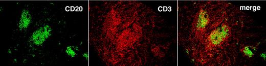 Figure 7. T cells localize preferentially in follicular structures found in the spleen. Spleen tissue with follicular structures stained with anti-CD20 (green) and anti-CD3 (red) mAbs. Images were taken with an Olympus IX70 confocal microscope, at 25°C, with the use of UPlanAPO 10×/0.40 objective. Antibodies were labeled with DyLight 488 and 649 (Jackson ImmunoResearch Laboratories Inc) excited with one 30-mW argon laser at 488 nm and one 5-mW helium-neon laser exciting at 633 nm. Samples were mounted in SlowFade Gold antifade reagent and data acquired with proprietary image acquisition software (Olympus).