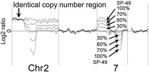Figure 4. Log2 ratio reflects the ratio of tumor. The genome profiles of mixed-DNA samples comprising various ratios were superimposed. Gain was detected in chromosome 7 of all mixed samples, as shown by the log2 ratio: SP-49 = 0.55; 100%, 7:3 = 0.46; 70%, 6:4 = 0.32; 60%, 3:7 = 0.20; 30%. Loss was also detected in chromosome 7 of all mixed samples as shown by the log2 ratio: Sp-49 = −0.88; 100%, 7:3 = −0.62; 70%, 6:4 = −0.39; 60%, 3:7 = −0.14; 30%. Chromosome 2p had a copy region identical to both SP-49 and HANK1. The log2 ratios never changed in these regions.